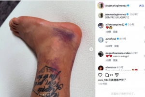 巴西vs挪威直播_巴西vs挪威比赛直播_巴西vs挪威高清比赛直播